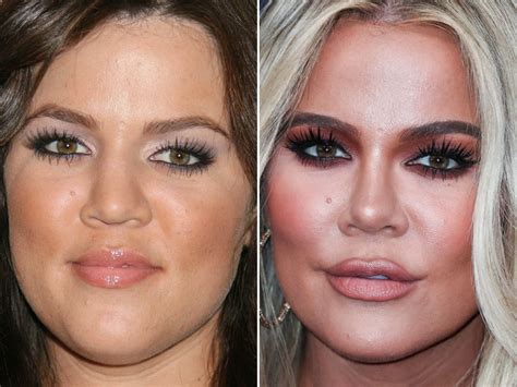 khloe before and after